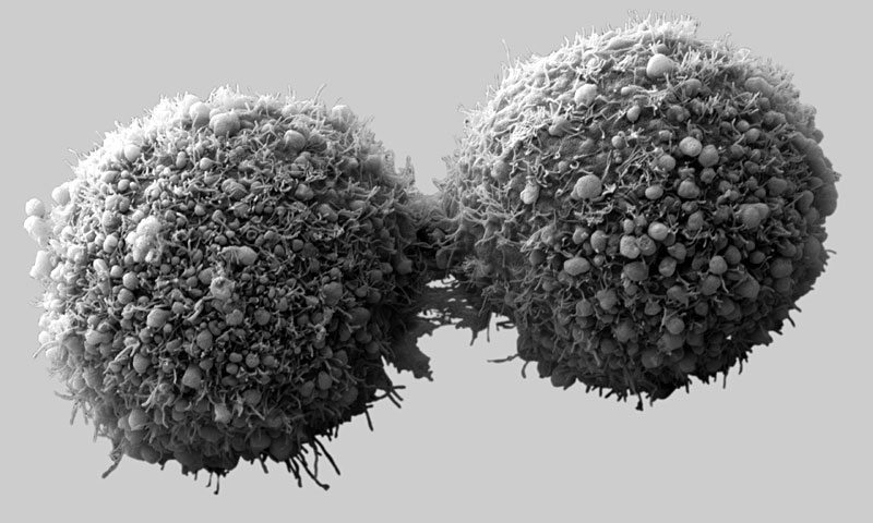 cancercells